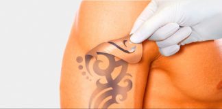 Як видалити тату