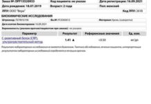 Аналізи. Подивитися. Температура .