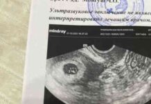 Метод рамзі