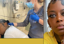 Склеїла стан: американка, яка зробила з волосся панцир через будівельного клею, знову їх спалила