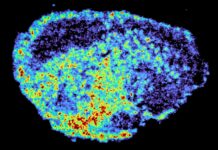 Чому Деякі Протиракові Препарати Не Працюють: Нерівномірний Розподіл Ліків Усередині Пухлин