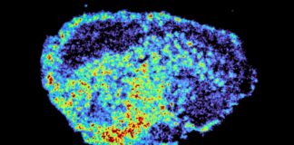 Чому Деякі Протиракові Препарати Не Працюють: Нерівномірний Розподіл Ліків Усередині Пухлин