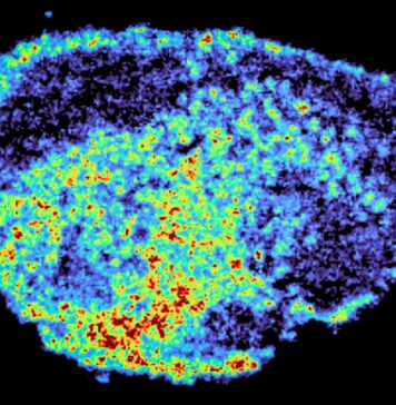 Чому Деякі Протиракові Препарати Не Працюють: Нерівномірний Розподіл Ліків Усередині Пухлин