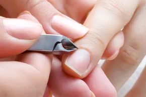 Чому прикушування нігтів викликає відшарування кутикули та нігтів: посібник з пароніхії